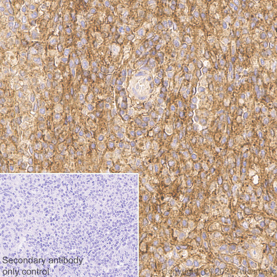 Immunohistochemistry (Formalin/PFA-fixed paraffin-embedded sections) - Anti-CD47 antibody [RM1014] (AB284132), expandable thumbnail