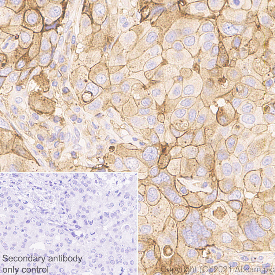 Immunohistochemistry (Formalin/PFA-fixed paraffin-embedded sections) - Anti-CD47 antibody [RM1014] (ab284132), expandable thumbnail