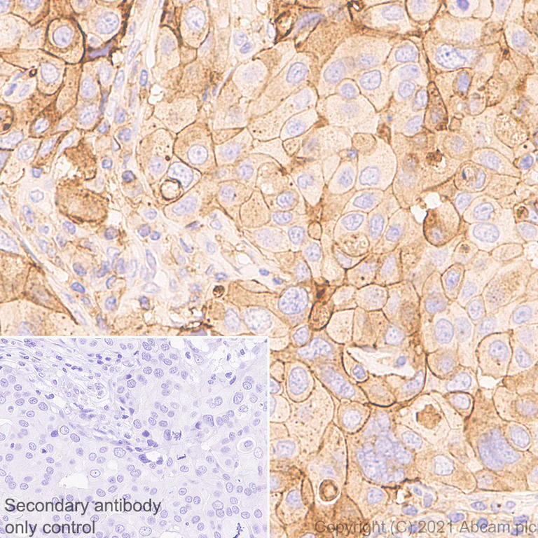 Immunohistochemistry (Formalin/PFA-fixed paraffin-embedded sections) - Anti-CD47 antibody [RM1014] (AB284132)