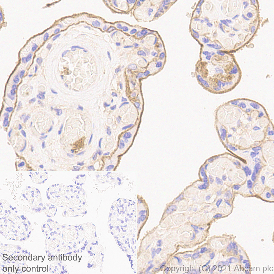 Immunohistochemistry (Formalin/PFA-fixed paraffin-embedded sections) - Anti-CD47 antibody [RM1014] (ab284132), expandable thumbnail