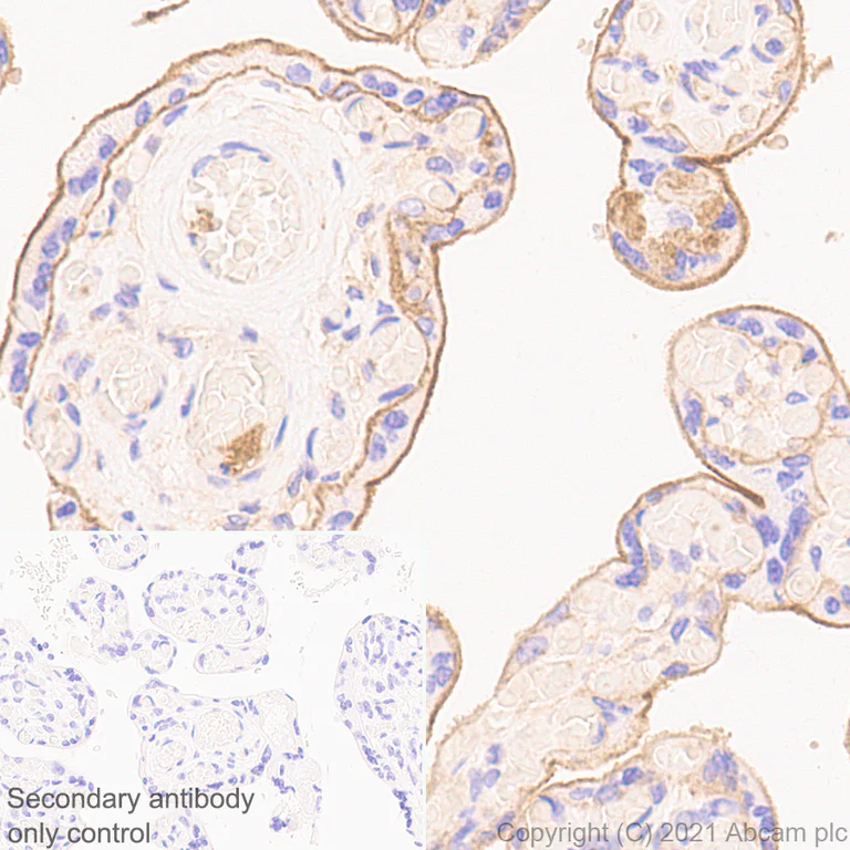 Immunohistochemistry (Formalin/PFA-fixed paraffin-embedded sections) - Anti-CD47 antibody [RM1014] (AB284132)