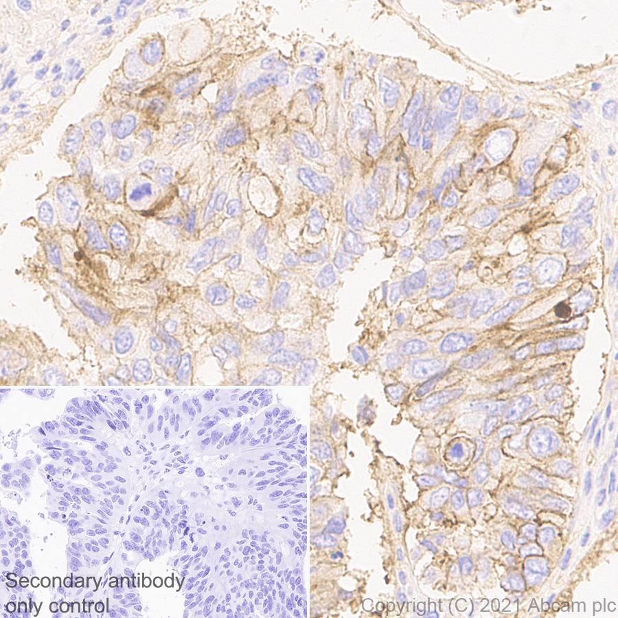 Immunohistochemistry (Formalin/PFA-fixed paraffin-embedded sections) - Anti-CD47 antibody [RM1014] (ab284132), expandable thumbnail