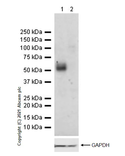 Western blot - Anti-CD47 antibody [RM1014] (AB284132)