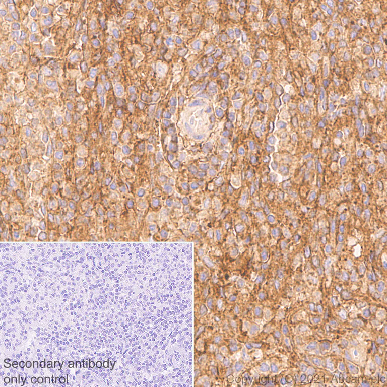 Immunohistochemistry (Formalin/PFA-fixed paraffin-embedded sections) - Anti-CD47 antibody [RM1014] - BSA and Azide free (AB284138)