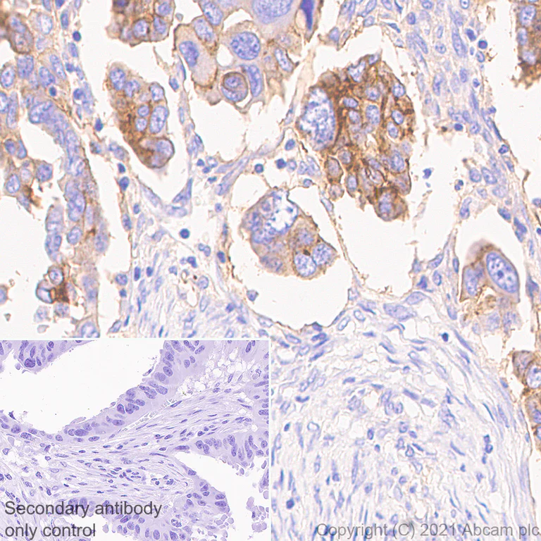 Immunohistochemistry (Formalin/PFA-fixed paraffin-embedded sections) - Anti-CD47 antibody [RM1014] - BSA and Azide free (AB284138)