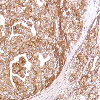 Immunohistochemistry (Formalin/PFA-fixed paraffin-embedded sections) - Anti-CD47 antibody [SP279] (AB226837)