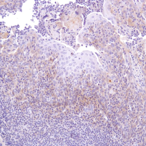 Immunohistochemistry (Formalin/PFA-fixed paraffin-embedded sections) - Anti-CD47 antibody [SP279], prediluted (ab228193), expandable thumbnail