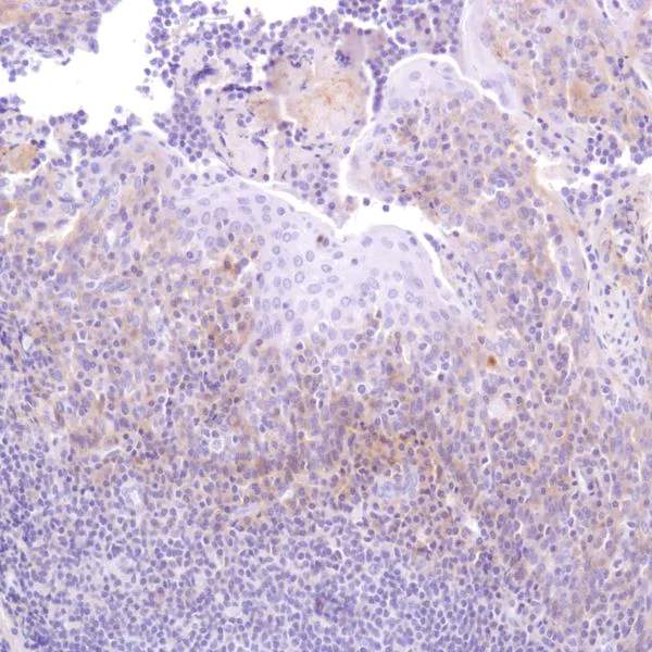 Immunohistochemistry (Formalin/PFA-fixed paraffin-embedded sections) - Anti-CD47 antibody [SP279], prediluted (AB228193)