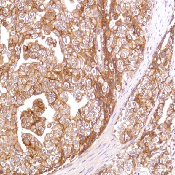 Immunohistochemistry (Formalin/PFA-fixed paraffin-embedded sections) - Anti-CD47 antibody [SP279], prediluted (AB228193), expandable thumbnail
