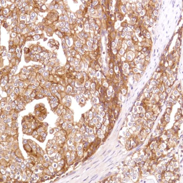 Immunohistochemistry (Formalin/PFA-fixed paraffin-embedded sections) - Anti-CD47 antibody [SP279], prediluted (AB228193)