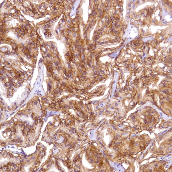 Immunohistochemistry (Formalin/PFA-fixed paraffin-embedded sections) - Anti-CD47 antibody [SP279], prediluted (AB228193), expandable thumbnail