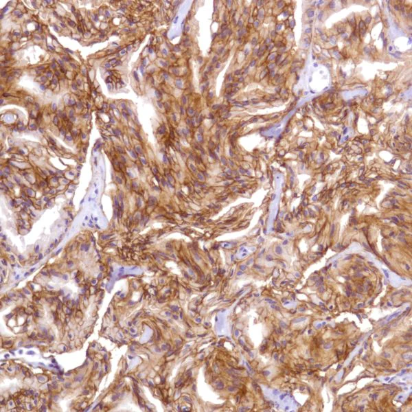 Immunohistochemistry (Formalin/PFA-fixed paraffin-embedded sections) - Anti-CD47 antibody [SP279], prediluted (AB228193)