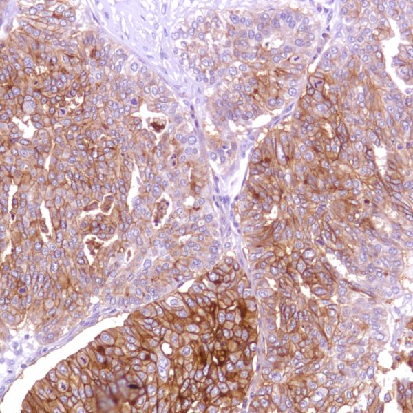 Immunohistochemistry (Formalin/PFA-fixed paraffin-embedded sections) - Anti-CD47 antibody [SP279], prediluted (AB228193), expandable thumbnail