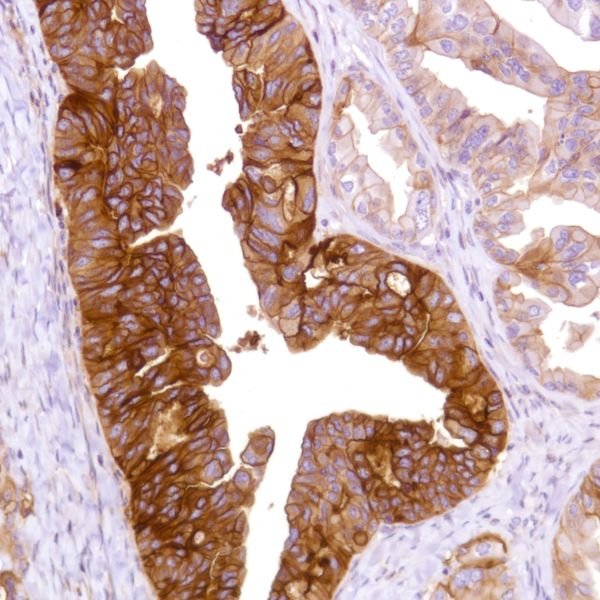 Immunohistochemistry (Formalin/PFA-fixed paraffin-embedded sections) - Anti-CD47 antibody [SP279], prediluted (AB228193), expandable thumbnail
