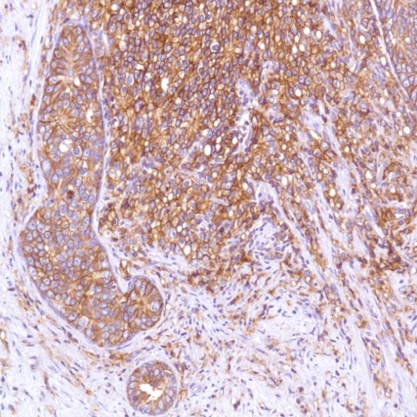 Immunohistochemistry (Formalin/PFA-fixed paraffin-embedded sections) - Anti-CD47 antibody [SP279], prediluted (ab228193), expandable thumbnail