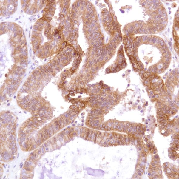 Immunohistochemistry (Formalin/PFA-fixed paraffin-embedded sections) - Anti-CD47 antibody [SP279], prediluted (AB228193), expandable thumbnail