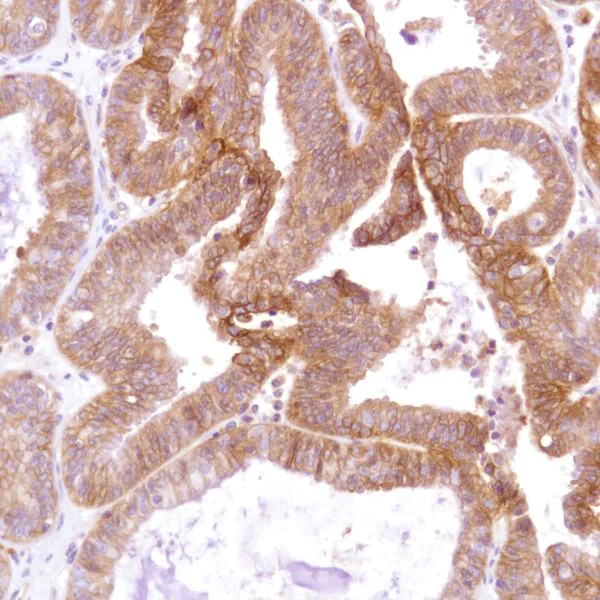 Immunohistochemistry (Formalin/PFA-fixed paraffin-embedded sections) - Anti-CD47 antibody [SP279], prediluted (AB228193)