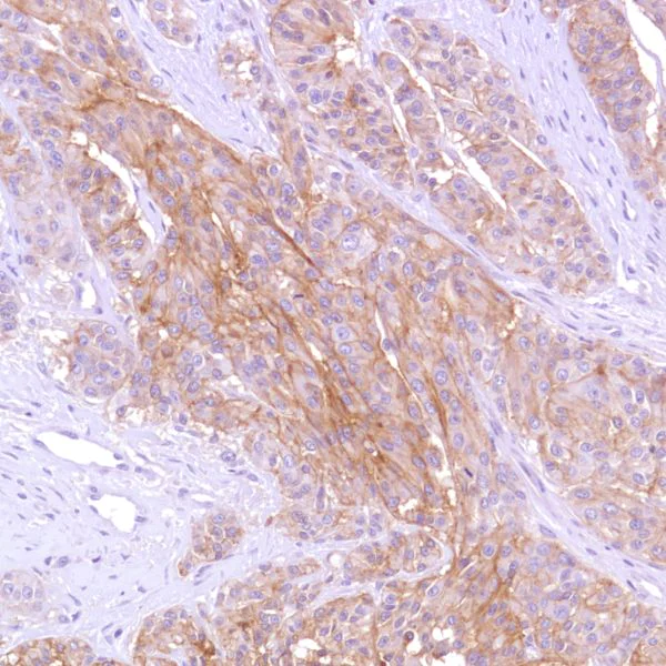 Immunohistochemistry (Formalin/PFA-fixed paraffin-embedded sections) - Anti-CD47 antibody [SP279], prediluted (AB228193)