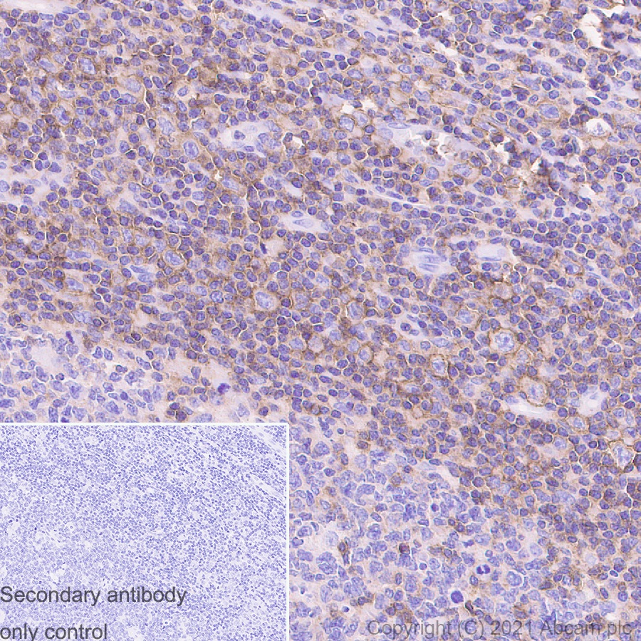 Immunohistochemistry (Formalin/PFA-fixed paraffin-embedded sections) - Anti-CD48 antibody [EPR4108] (AB134049)