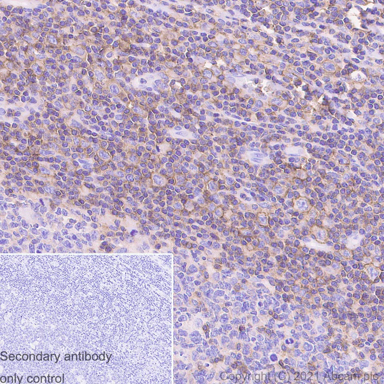 Immunohistochemistry (Formalin/PFA-fixed paraffin-embedded sections) - Anti-CD48 antibody [EPR4108] (AB134049)