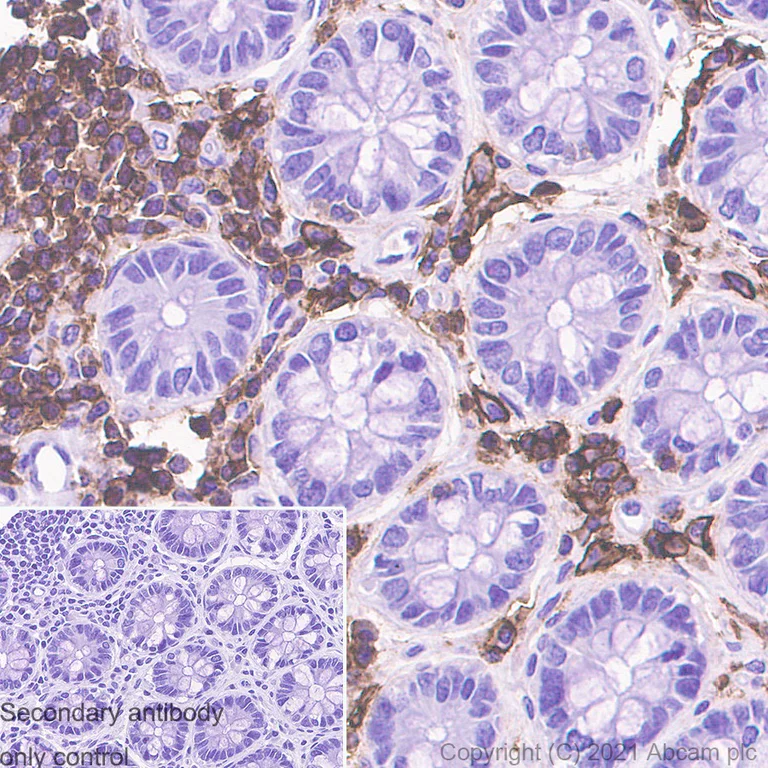Immunohistochemistry (Formalin/PFA-fixed paraffin-embedded sections) - Anti-CD48 antibody [EPR4108] - BSA and Azide free (AB248658)