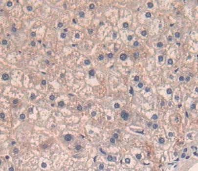 Immunohistochemistry (Formalin/PFA-fixed paraffin-embedded sections) - Anti-CD5 antibody (AB232713), expandable thumbnail