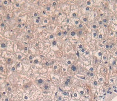 Immunohistochemistry (Formalin/PFA-fixed paraffin-embedded sections) - Anti-CD5 antibody (AB232713)