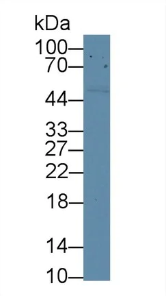 Western blot - Anti-CD5 antibody (AB232713)