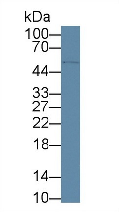 Western blot - Anti-CD5 antibody (AB232713), expandable thumbnail