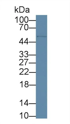 Western blot - Anti-CD5 antibody (AB232713)
