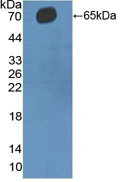 Western blot - Anti-CD5 antibody (AB232713), expandable thumbnail
