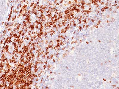 Immunohistochemistry (Formalin/PFA-fixed paraffin-embedded sections) - Anti-CD5 antibody [C5/473] (AB201338), expandable thumbnail