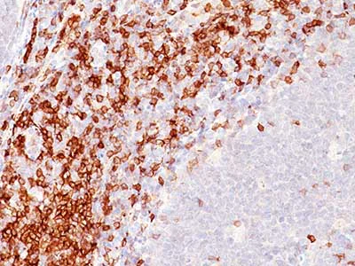 Immunohistochemistry (Formalin/PFA-fixed paraffin-embedded sections) - Anti-CD5 antibody [C5/473] (AB201338)
