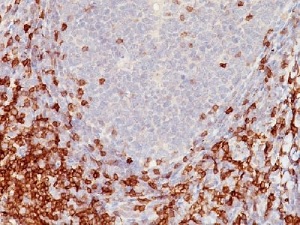 Immunohistochemistry (Formalin/PFA-fixed paraffin-embedded sections) - Anti-CD5 antibody [C5/473] - BSA and Azide free (AB213001), expandable thumbnail