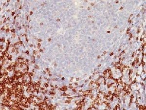 Immunohistochemistry (Formalin/PFA-fixed paraffin-embedded sections) - Anti-CD5 antibody [C5/473] - BSA and Azide free (AB213001)
