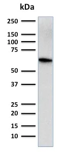 Western blot - Anti-CD5 antibody [CD5/2416] (AB238086)
