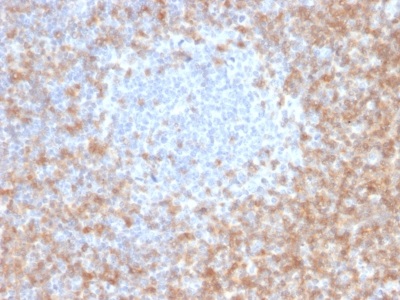 Immunohistochemistry (Formalin/PFA-fixed paraffin-embedded sections) - Anti-CD5 antibody [CD5/2416] - BSA and Azide free (AB237940), expandable thumbnail