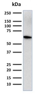 Western blot - Anti-CD5 antibody [CD5/2416] - BSA and Azide free (AB237940), expandable thumbnail