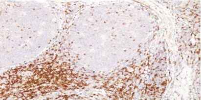 Immunohistochemistry (Formalin/PFA-fixed paraffin-embedded sections) - Anti-CD5 antibody [CD5/54/F6] - BSA and Azide free (AB213003), expandable thumbnail