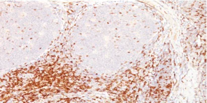 Immunohistochemistry (Formalin/PFA-fixed paraffin-embedded sections) - Anti-CD5 antibody [CD5/54/F6] - BSA and Azide free (AB213003)