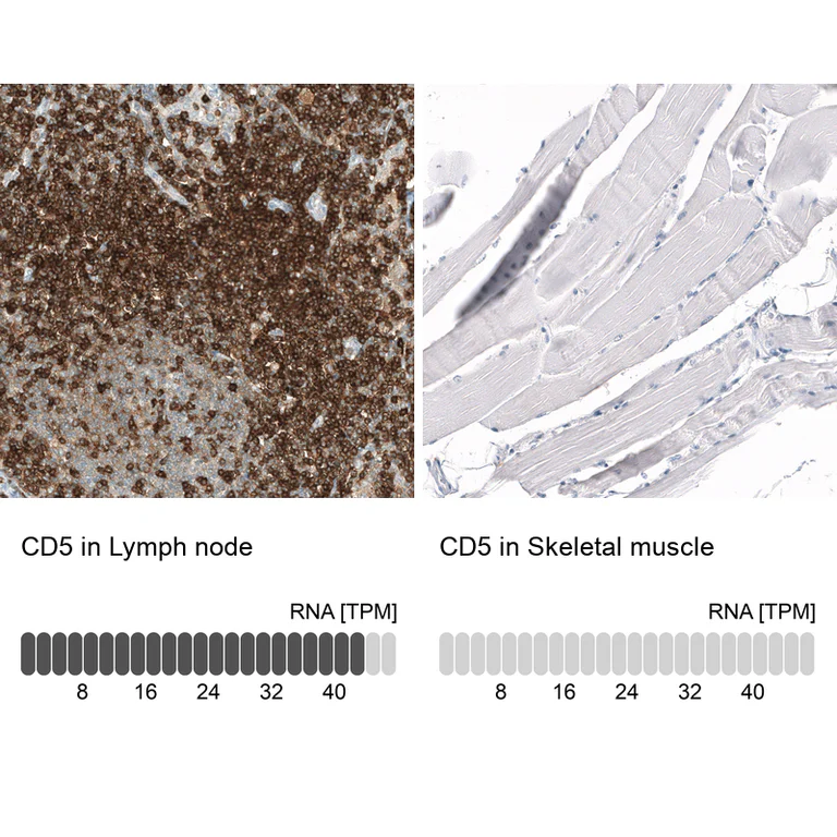 Immunohistochemistry (Formalin/PFA-fixed paraffin-embedded sections) - Anti-CD5 Antibody [CL12334] (AB327140)