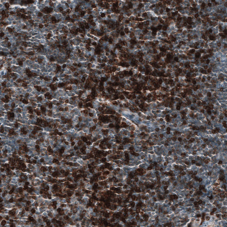 Immunohistochemistry (Formalin/PFA-fixed paraffin-embedded sections) - Anti-CD5 Antibody [CL12334] (AB327140)