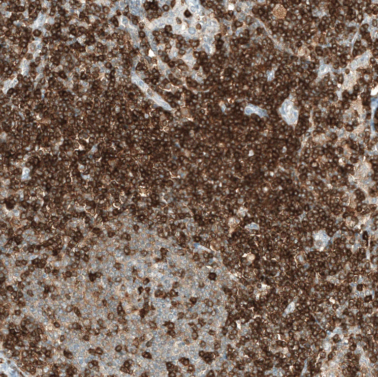 Immunohistochemistry (Formalin/PFA-fixed paraffin-embedded sections) - Anti-CD5 Antibody [CL12334] (AB327140)