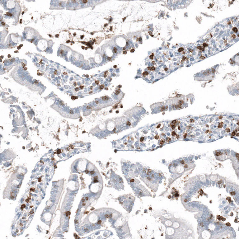 Immunohistochemistry (Formalin/PFA-fixed paraffin-embedded sections) - Anti-CD5 Antibody [CL12334] (AB327140)