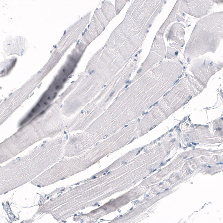 Immunohistochemistry (Formalin/PFA-fixed paraffin-embedded sections) - Anti-CD5 Antibody [CL12334] (AB327140)