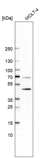 Western blot - Anti-CD5 Antibody [CL12334] (AB327140)