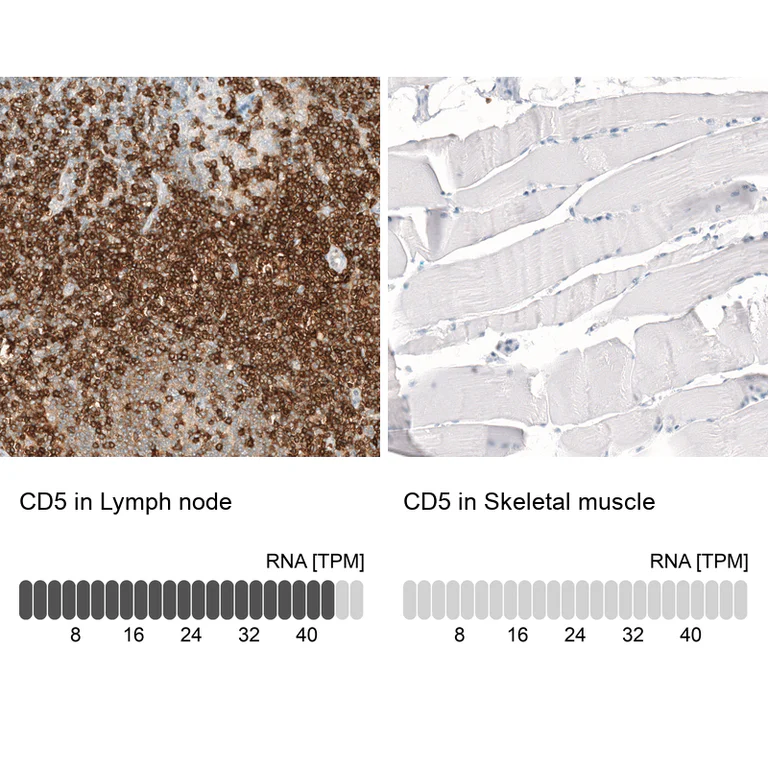 Immunohistochemistry (Formalin/PFA-fixed paraffin-embedded sections) - Anti-CD5 Antibody [CL12420] (AB327141)