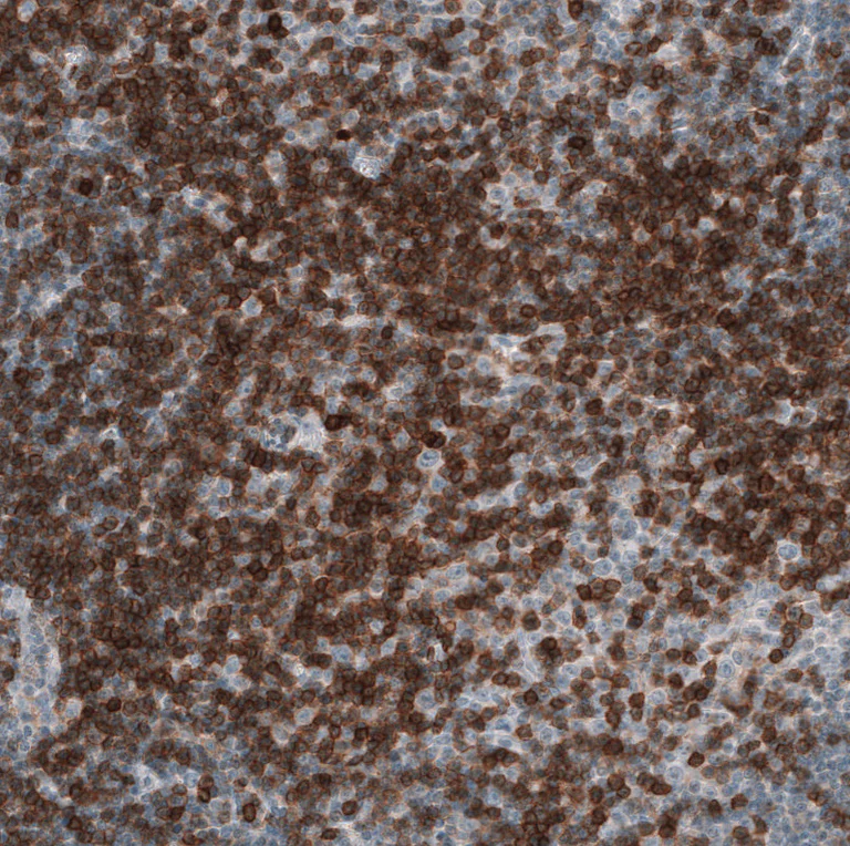 Immunohistochemistry (Formalin/PFA-fixed paraffin-embedded sections) - Anti-CD5 Antibody [CL12420] (AB327141)