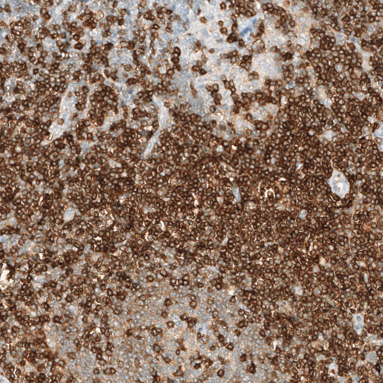 Immunohistochemistry (Formalin/PFA-fixed paraffin-embedded sections) - Anti-CD5 Antibody [CL12420] (AB327141)