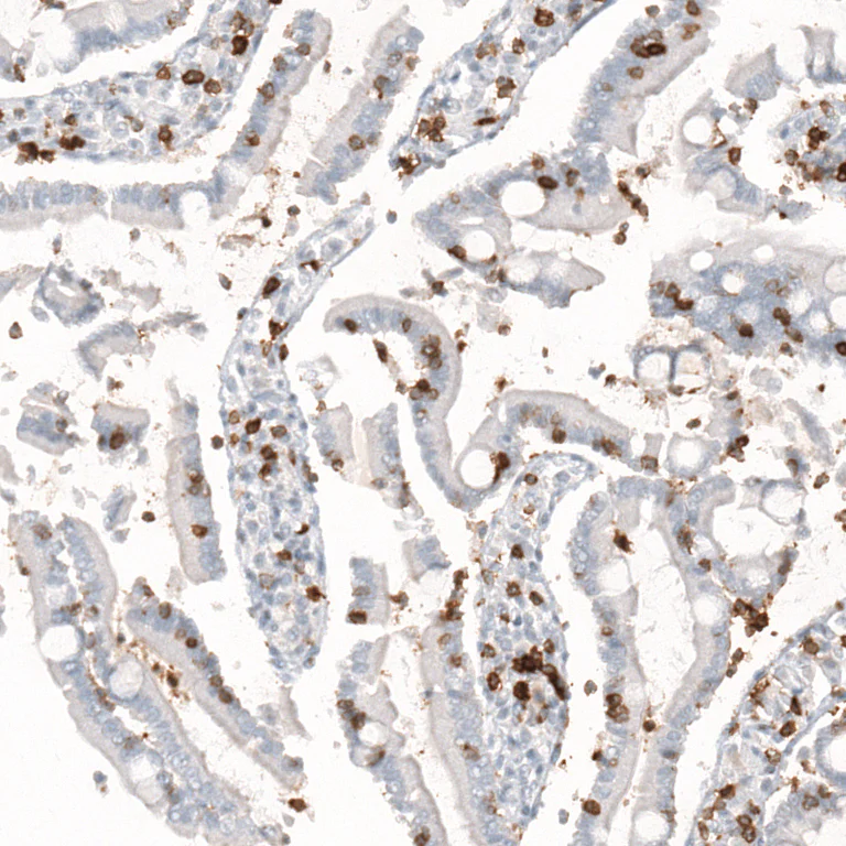 Immunohistochemistry (Formalin/PFA-fixed paraffin-embedded sections) - Anti-CD5 Antibody [CL12420] (AB327141)